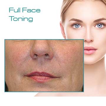 Q-Switched Nd:Yag Laser Applications Full Face Toning Detail