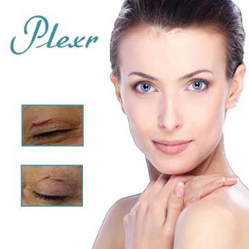 Plexr Skin Rejuvenation and Wrinkles Detail Information
