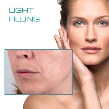Wrinkle Treatmensts with Anti-aging Filling Applications Light Filling Redensity I Detail Information