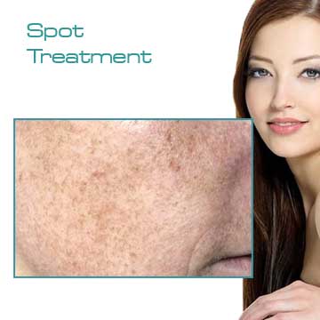 Spot Treatment Skin Rejuvenation and Skin Care Applications and Skin Renewal Detail Information
